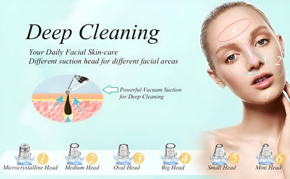 NuVac™ Skin Extractor
